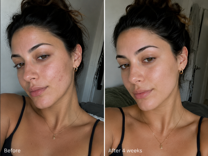 Fine Lines