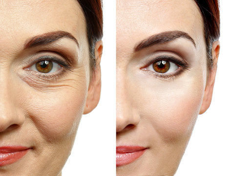 Uneven Skin Tone