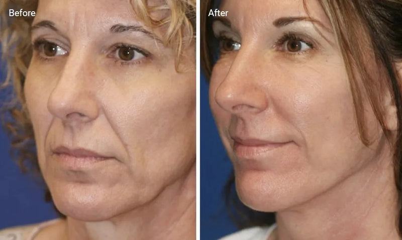 Anti-Aging